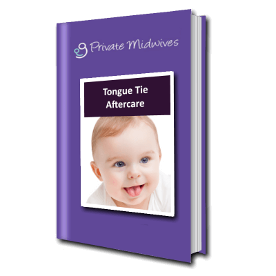 Tongue Tie aftercare information from Private Midwives