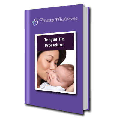 Tongue Tie procedure information from Private Midwives
